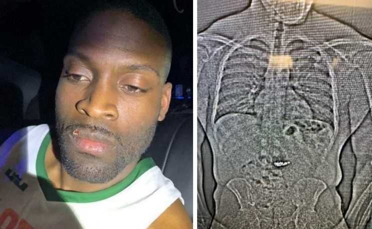Florida man who swallowed nearly $1M in stolen jewelry found guilty of robbery — WTAE 4 (Pittsburgh)